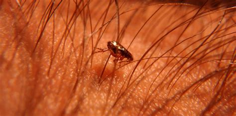 Sand Flea Disease Is Neglected What Needs To Be Done