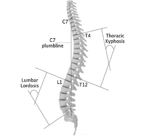 Sagittal Curvatures Of The Spine Lumbar Lordosis And Thoracic
