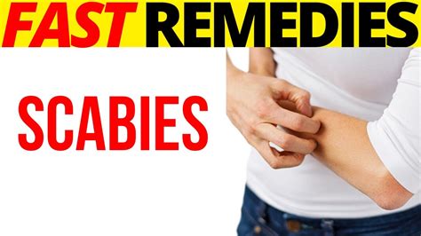 🌼 🌼7 Most Effective Home Remedies For Scabies Youtube