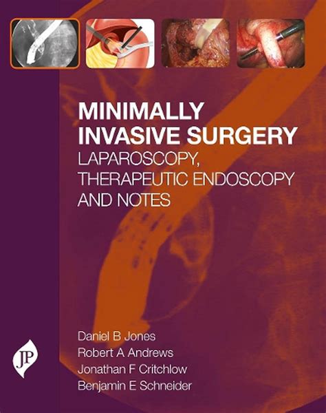 Minimally Invasive Surgery Laparoscopy Therapeutic Endoscopy And