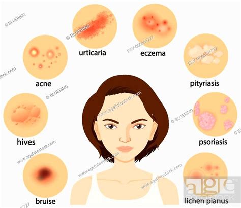 Diagram Showing Different Skin Conditions Illustration Stock Vector