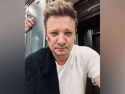 Marvel Star Jeremy Renner Reveals He Broke Over 30 Bones In Snow Plow