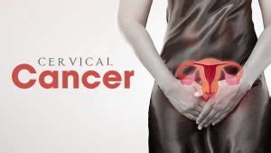What Are The Early Signs Symptoms Of Cervical Cancer Apollo