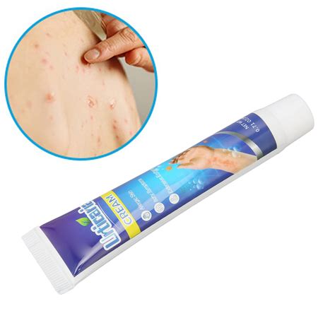 Itching Cream Pruritus Ointment For Dry Skin Adjunctive Treatment Microbiome Maintaining For