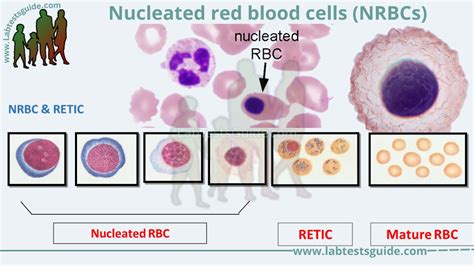 Nucleated Red Blood Cells Nrbcs Lab Tests Guide