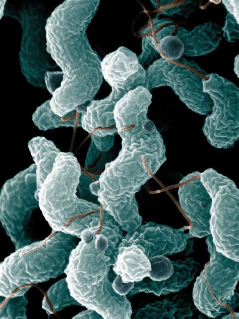 Campylobacter Description Infection Symptoms And Treatment Britannica