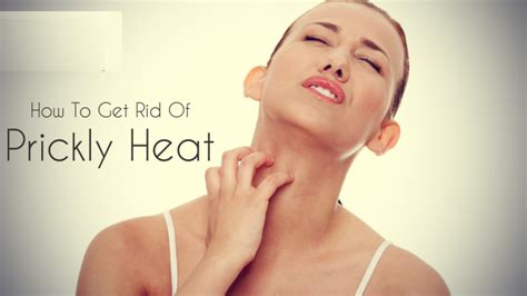 Tips To Save Yourself From Heat Rash Or Prickly Heat Prickly Heat