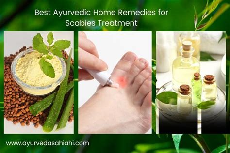 Best 8 Ayurvedic Home Remedies For Scabies Treatment