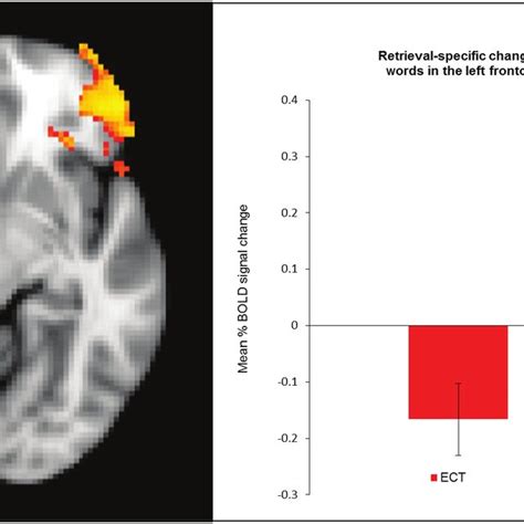 Brain Images Retrieval Specific Response In The Left Frontopolar