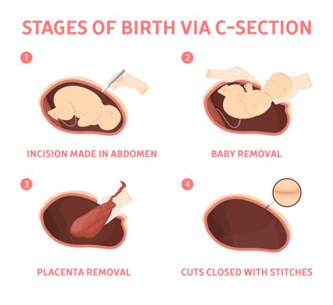 Give Birth Vectores Libres De Derechos Istock