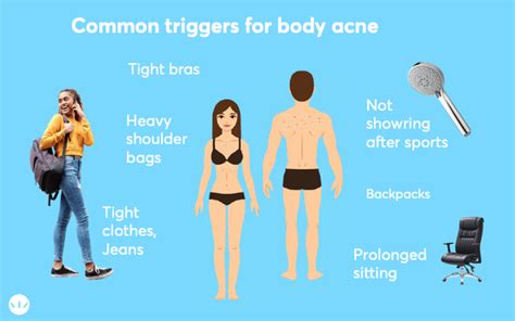 The Best Treatments For Body Acne Mdacne