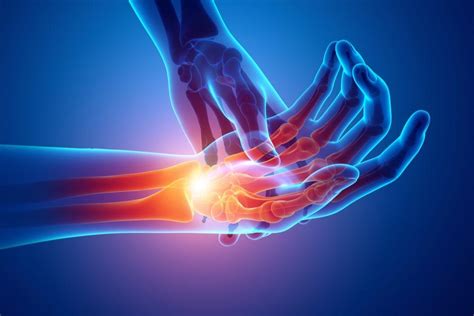 Hand Wrist Pain Specialist Palm Harbor FL Orthopedic Specialists Orthopedic Surgeon