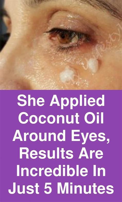 She Applied Coconut Oil Around Eyes Results Are Incredible In Just 5