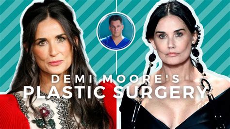 DEMI MOORE BEFORE AND AFTER Beverly Hills Plastic Surgeon Explains What Happened YouTube