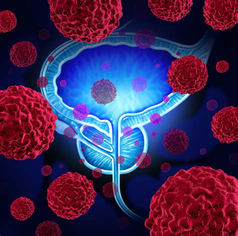 Castration Resistant Prostate Cancer Cell Growth Impeded By Endostatin