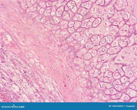 Histology Of Human Larynx Tissue Stock Photo Image Of Show