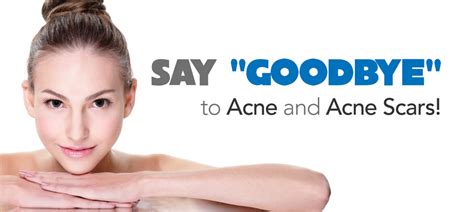 Acne And Acne Scars Skinpossible Calgary Laser Clinic