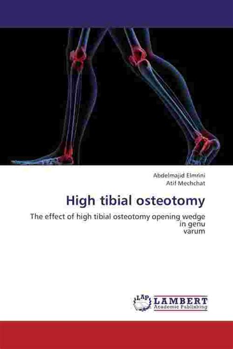 Pdf High Tibial Osteotomy By Abdelmajid Elmrini Ebook Perlego