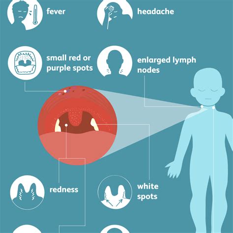 What Helps Strep Throat Examples And Forms