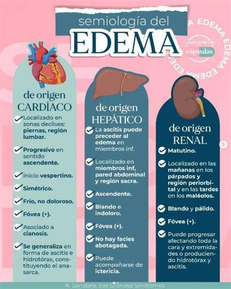Edema Infografia Simple Para Comprension De Paciente Edema Images And