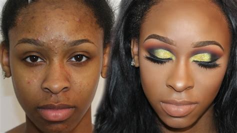 How To Cover Acne Scars And Bumps Dramatic Yellow Glitter