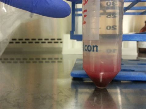 Cells were centrifuged for 20 min at 890 g (slow acceleration/deceleration off), washed three times with pbs. Can anyone help with problems with density-gradient ...