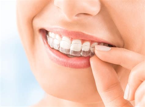 Orthodontic Tooth Movement Treatment Options With Clear Aligners
