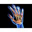 RA – What Is Rheumatoid Arthritis And How It Will Affect Your Life