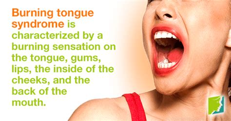 Burning Tongue Syndrome Menopause Now