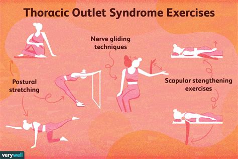 Thoracic Outlet Syndrome Physical Therapy What To Expect