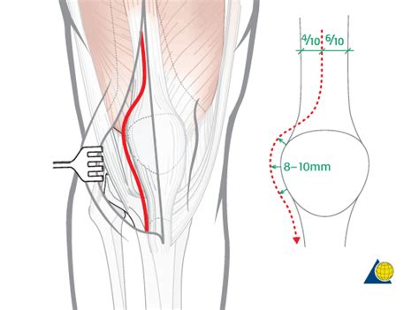 Synovectomy Knee Indications And Procedure Knee Knee Joint