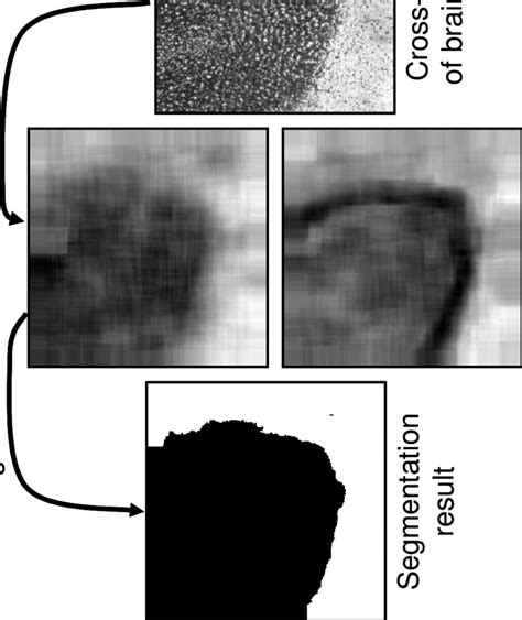 B Illustration Of The Textured Image Segmentation Procedure By Means