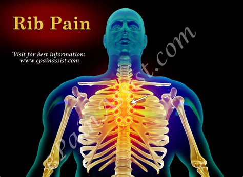 It is often linked to heart issues. Rib Pain|Classification|Types|Pathophysiology|Causes|Signs|Symptoms|Tests|Treatment
