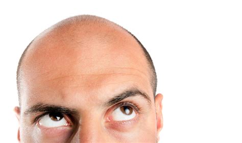 Breakthrough Brings Cure For Baldness Closer Buzzie