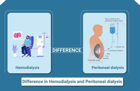 Know The Hemodialysis Vs Peritoneal Dialysis Alfa Kidney Care