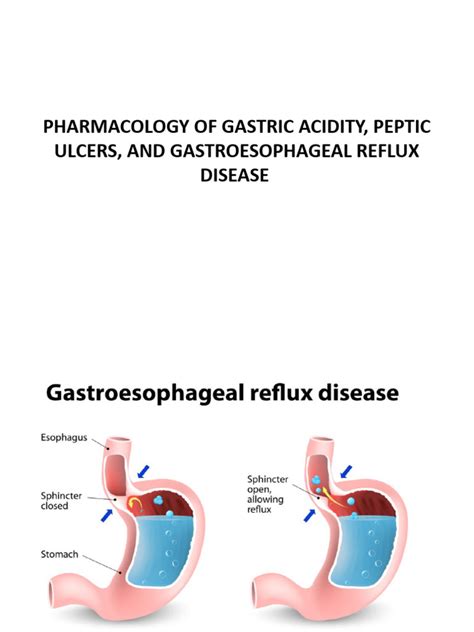 Pharmacotherapy Of Gastric Acidity Peptic Ulcers Pdf Medicinal