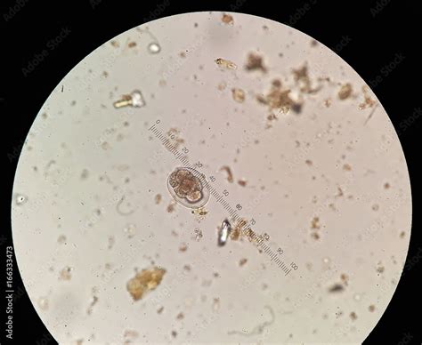 Hookworm Egg In Stool Examination Under 40x Light Microscope Stock