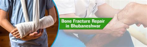 Everything You Need To Know About Bone Fracture Repair