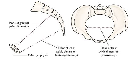 Ischial Spine Anatomy