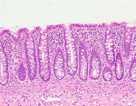 Colon Large Intestine Histology My XXX Hot Girl