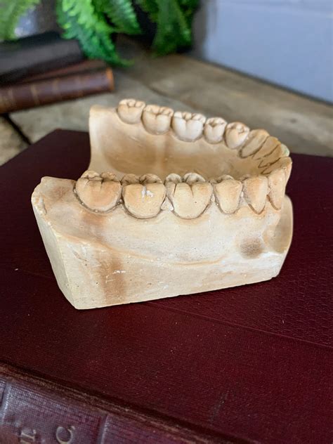 An Oversized Anatomicaldental Plaster Teeth Model Belle And Beast