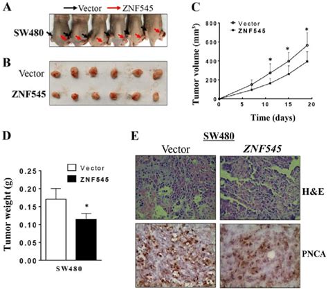 ZNF545 Inhibits Tumorigenicity Of CRC In Vivo A And B Representative