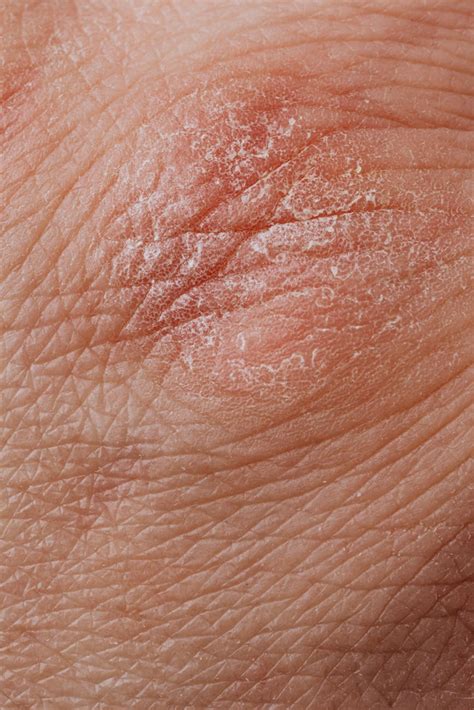 Close Up View Of Human Dry Skin · Free Stock Photo