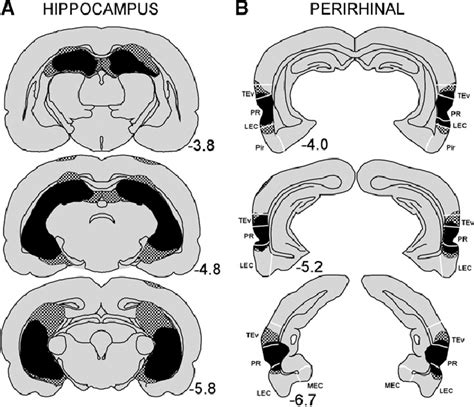 Reconstructions Of Coronal Sections Through The A Hippocampus And B