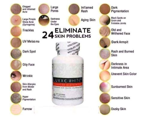 Facts Of Glutathione Skin Whitening Glutathione Pro