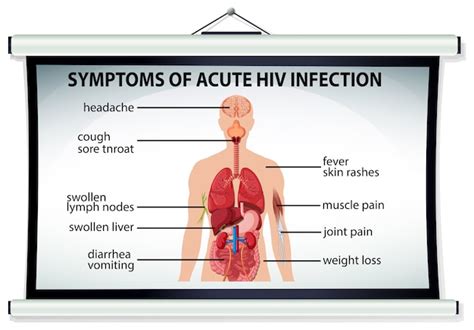 Gráfico Mostrando Sintomas De Infecção Aguda Pelo Hiv Vetor Grátis