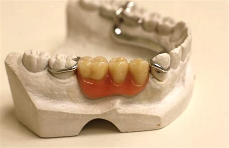 Use the illustrations and pronunciations below to get started. BABEH DENTAL: HARGA PASANG GIGI PALSU PALING MURAH DI ...