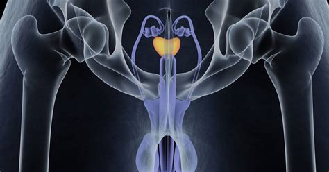 Rak Prostaty Objawy Przyczyny I Leczenie Panel Zdrowia
