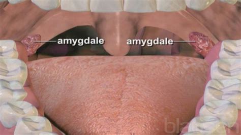 Amygdalite Linflammation Des Amygdales Expliquée En Vidéo Santé