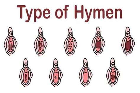 हाइमन क्या होता है क्या वर्जिनिटी से इसका कोई सम्बन्ध है What Is Hymen Virginity Myths And